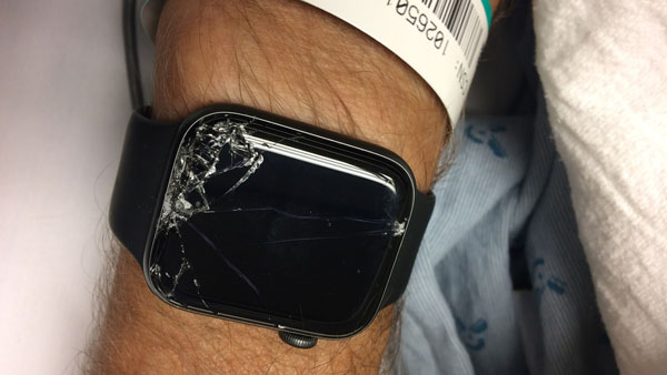 Apple Watch Hard Fall Feature Saves Mountain Biker’s Life; Alerts Emergency Services