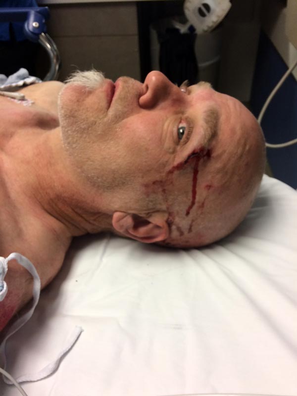Apple Watch Hard Fall Feature Saves Mountain Biker’s Life; Alerts Emergency Services