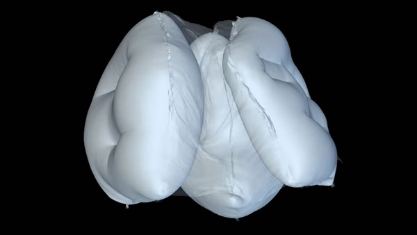 Acura Develops New Age Airbags Designed To Reduce Head And Brain Injuries